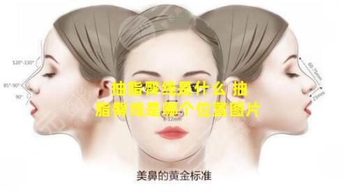抽脂臀线是什么 抽脂臀线是哪个位置图片